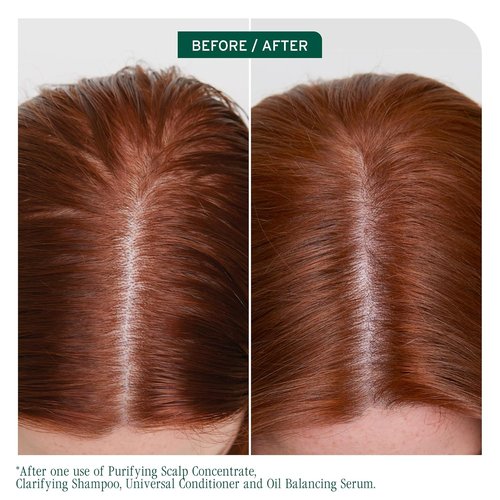 Biolage Scalp Sync Clarifying Shampoo - Effective Residue Remover for Oily Scalps | 13.5 Fl Oz