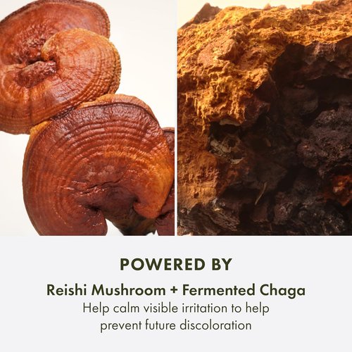 Origins Mega-Mushroom Dark Spot Serum - Reduces Hyperpigmentation & Post-Acne Marks | With Vitamin C & Reishi Mushroom, 1 Fl Oz