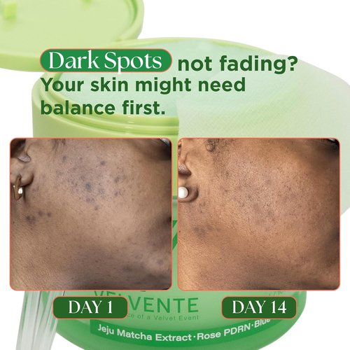 Regine Switzerland Matcha Facial Moisturizer - Hydrating Anti-Aging Cream with Rose PDRN & Peptides, 3.53 oz