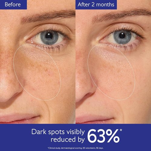 Caudalie Vinoperfect Brightening Dark Spot Serum - 62X More Effective Than Vitamin C for Even Skin Tone