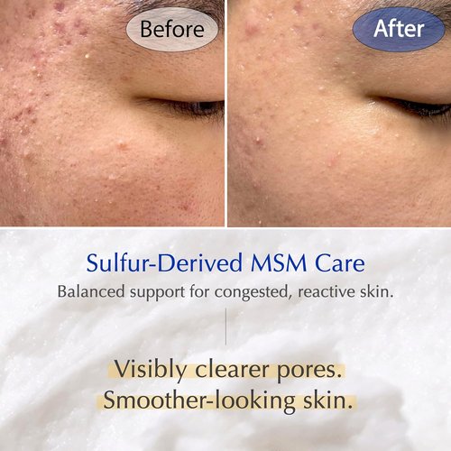 MSM Sulfur Deep Pore Cleanser - Gentle Low pH Face Wash for Sensitive Skin | Pore Reset Formula