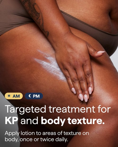 Remedy for Body Bumps | KP Exfoliating Body Moisturizer | Keratosis Pilaris (KP) Treatment For Textured, Crepey Skin with Urea, Lactic Acid, Retinol | Smoothing Body Lotion | By Dermatologist Dr. Shah