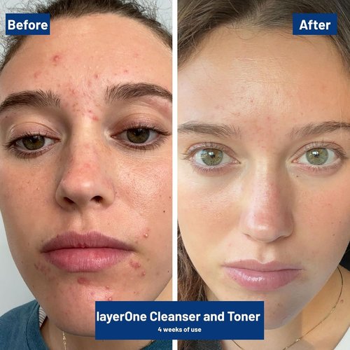 LayerOne Clarifying Enzyme Cleanser - Gentle Daily Exfoliant for Pore-Cleansing | 3.38 fl oz