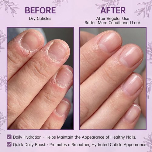 Skiennix Cuticle Oil Pen - Hydrating Nail Moisturizer with Jojoba Oil & Vitamin E | 15ml Portable Brush Pen