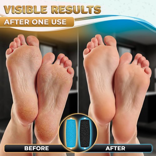 11 Pcs Replacement Rollers for Electric Foot Callus Remover Tool - 7 Extra Coarse & 4 Regular Coarse Refill Heads (1.92 x 0.65 Inches), Micro-Diamond Crystals - Compatible with Amope Pedi Perfect Pro