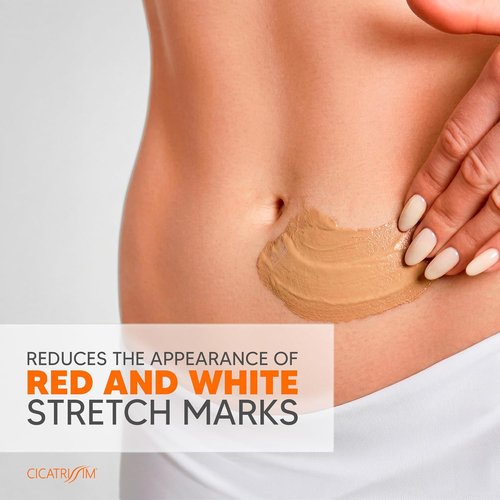 Cicatrissim Stretch Mark Cream - Softens & Firms Skin, Evens Tone - 150g for All Skin Types