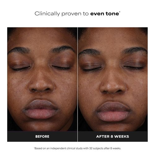 Paula’s Choice 25% Vitamin C Serum - Brightening Face Serum with Antioxidants | Fragrance-Free, 1oz