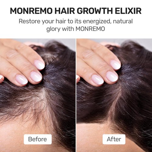 Skiennix Hair Growth Serum - Fast-Absorbing Turmeric & Caffeine Formula for Thinning Hair | Vegan Scalp Treatment
