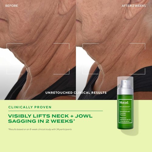 Murad Retinal ReSculpt Overnight Treatment - Advanced Face & Neck Serum for Deep Wrinkles & Sagging Skin