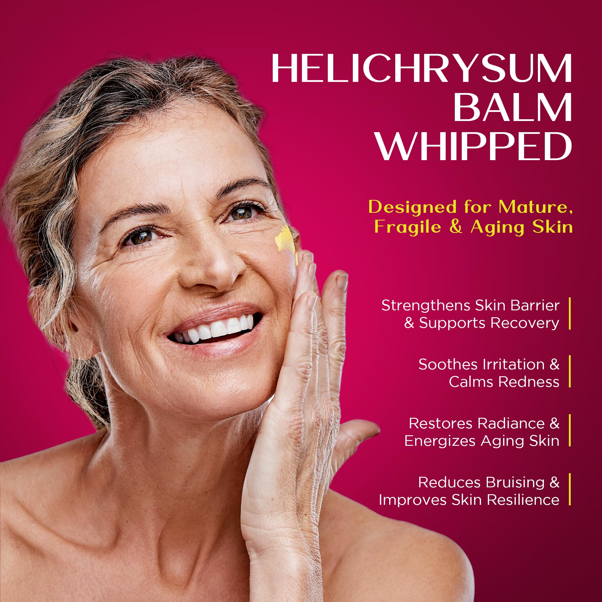 Vigority Helichrysum Balm Soothes & Repairs: Restorative Cream with Arnica & Calendula for Thin, Fragile, Bruised & Aging Skin – Moisturizes & Revitalizes Face & Body – Whipped Texture – 3.4 oz