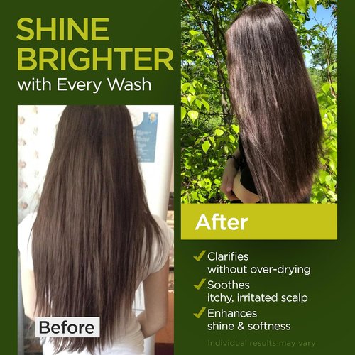 Tea Tree Rosemary Shampoo & Conditioner Set - Nourishing Castor Oil for All Hair Types | Paraben & Sulfate Free (16 Oz Each)