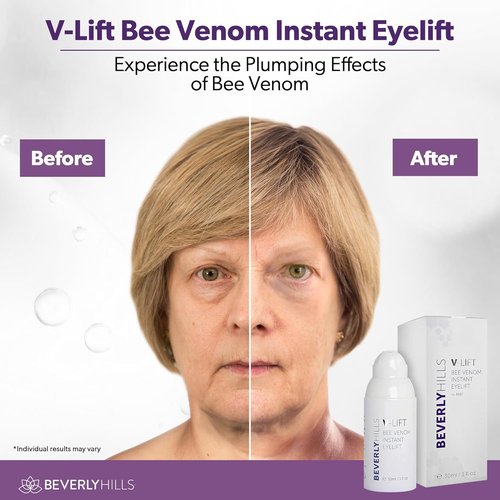 Beverly Hills V-Lift Bee Venom Eye Serum - Instant Lift for Dark Circles & Puffiness | 30mL (120 Day Supply)