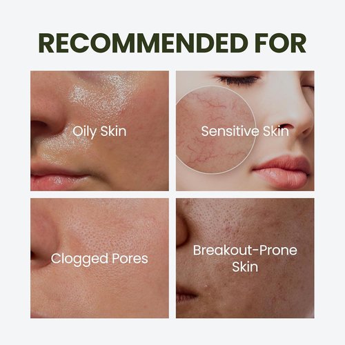 HyCicaMue Defence Cream - Soothing Barrier Repair Moisturizer with Cica & Hyaluronic Acid | Vegan Formula for Sensitive Skin, Hydration Boost