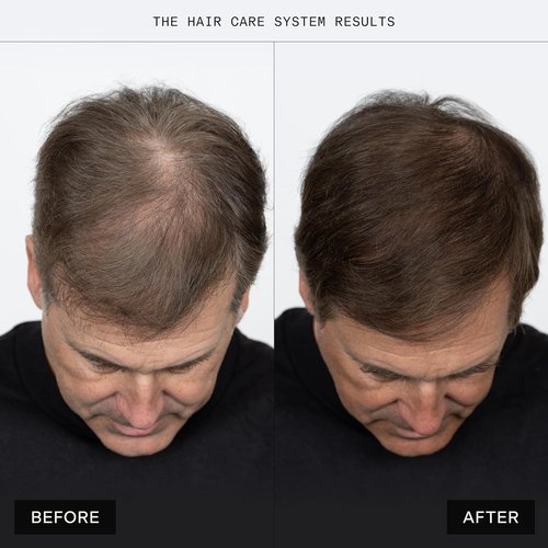 Caldera + Lab The Shampoo - Sulfate-Free Daily Cleanser for Healthy Hair | Dermatologically Tested for All Hair Types