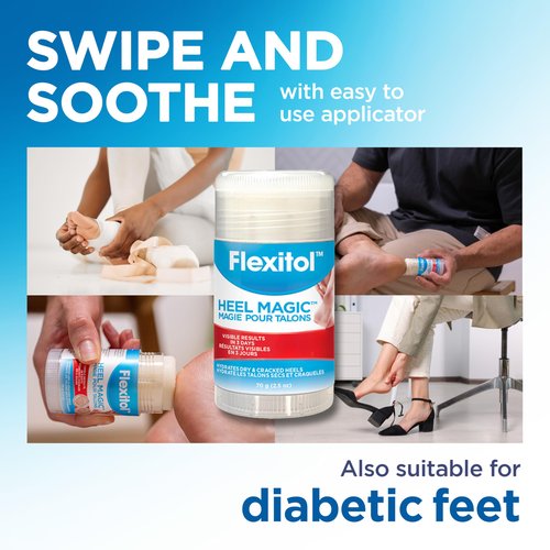 Flexitol Heel Magic Stick Two Pack, Cracked Heel Cream & Foot Balm, Urea-Based Moisturizing Stick with Shea Butter & Vitamin E, 2.5 oz