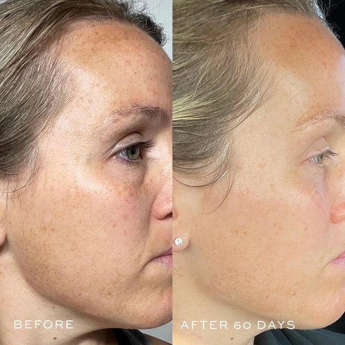 DIME Beauty TBT Serum - Vegan Anti-Aging Face Serum with Bakuchiol & Niacinamide | 1 oz / 30 ml