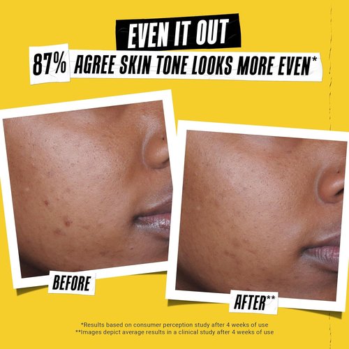 Kiehl's Better Screen UV Serum SPF 50+ - Invisible Facial Sunscreen with Collagen Peptide & UV Protection