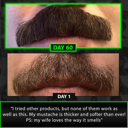 Skiennix Beard Growth Kit - 2X Thickening Biotin Balm & Conditioner + 6X Liquid Biotin with Collagen Peptides for Enhanced Beard & Hair Growth