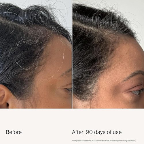 Living Proof Scalp Care Density Serum - Boost Hair Thickness & Nourish Scalp | 1.7 oz