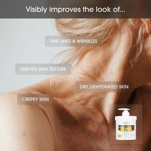 Advanced Clinicals Retinol Body Lotion - Anti-Aging Moisturizer for Fine Lines & Wrinkles | 16 Ounce