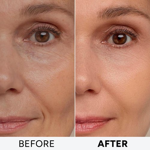 Regine Switzerland Retinol Cream - Anti-Aging Moisturizer with Collagen & Hyaluronic Acid | Day & Night Use