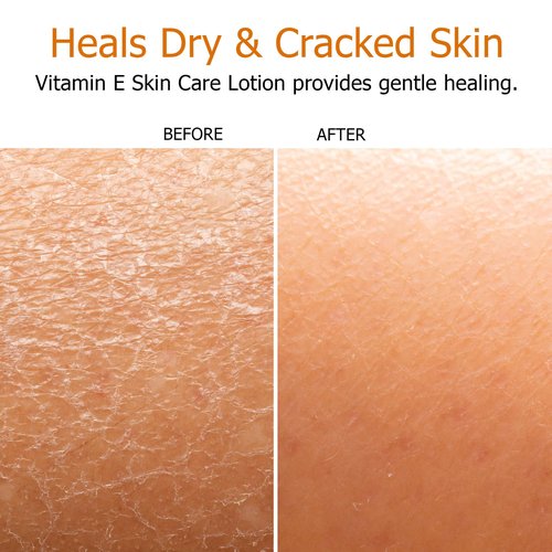 Fruit of the Earth Vitamin E Lotion 16 oz (2 Pack)