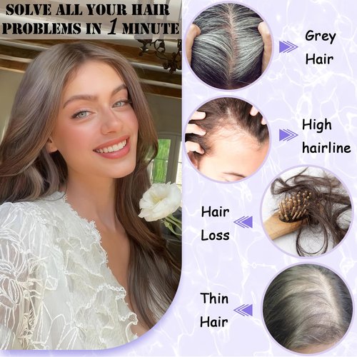 LEDIZE Hair Toppers for Women Real Human Hair, 360° Cover Middle Part Human Hair Toppers for Women with Thinning Realistic Scalp Line Upgrade Basement Toppers Hair Pieces Medium Brown, Side Bangs