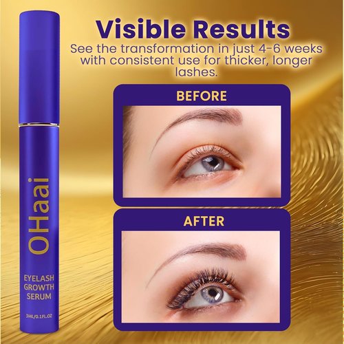 Skiennix Eyelash Growth Serum - Prostaglandin-Free Formula for Thicker, Fuller Lashes | Vegan & Cruelty-Free, 3ml