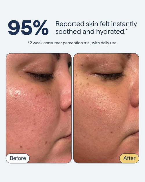 Dr. Shah Remedy for Light Moisture - Hydrating Gel Moisturizer for Normal to Oily Skin | 1.7 fl. oz.