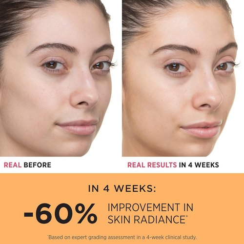 IT Cosmetics Bye Bye Dullness Vitamin C Serum - Boost Radiance & Hydrate in 10 Days - .85 fl oz