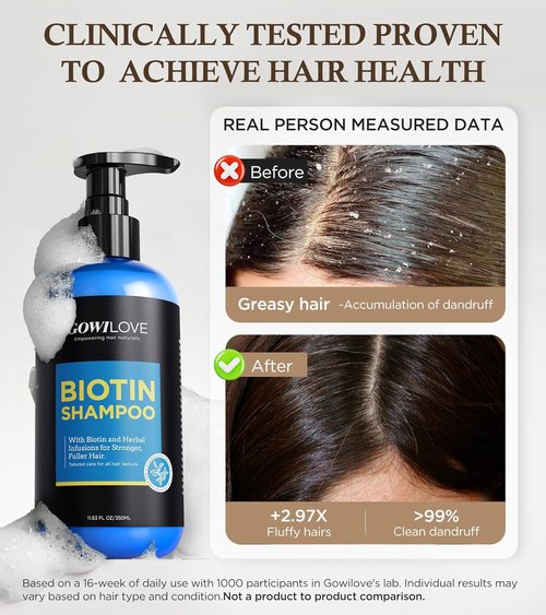 Skiennix 99% Pure Biotin Shampoo - 3X Thicker, Fuller Hair Growth & Dandruff Treatment | 11.83oz