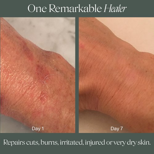Doctor Rogers Restore Healing Balm. Multi-Purpose Healing Ointment & Moisturizing Relief Gel. Protects & Soothes Injured, Sensitive & Dry Skin 0.5 Ounce Tube (14 gram)