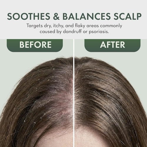 Skiennix Leave-In Conditioner Spray - Tea Tree Scalp Treatment for Dandruff Relief | Hydrating Formula for Dry, Itchy Scalp