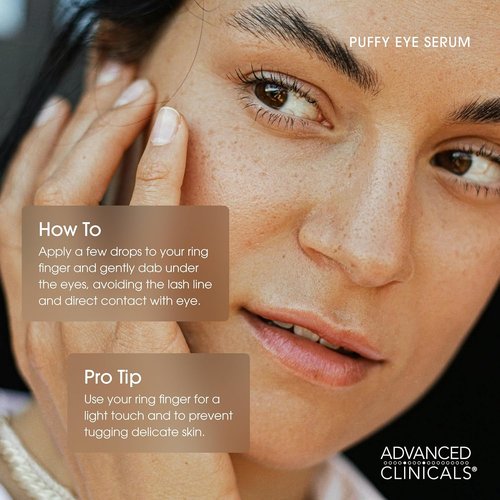 Advanced Clinicals Under Eye Serum - Brightening Vitamin C & Caffeine for Puffiness, Fine Lines & Dark Circles | 1.75 Fl Oz
