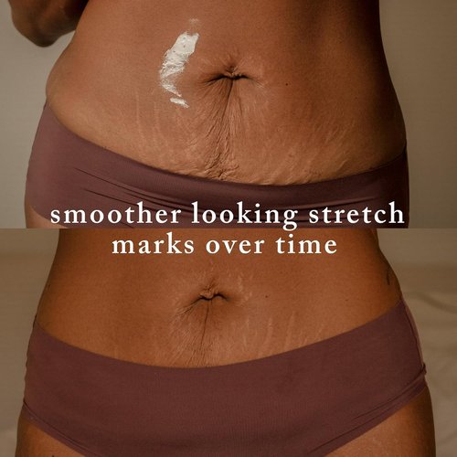 Nemah Stretch Mark Cream - Moisturizing Pregnancy Body Cream with Shea Butter & Macadamia Oil | 3.4 oz