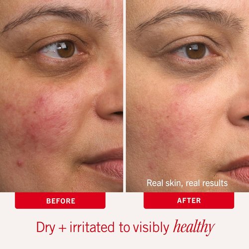 First Aid Beauty - Ultra Repair Cream - Hydrating Face & Body Moisturizer - Strengthens Skin Barrier in 7 Days | 6oz Plus 1oz Tube