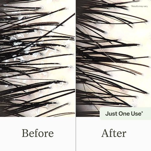 Divi Clarifying Scalp Reset Shampoo - Deep Cleansing Treatment for Product Buildup & Hard Water