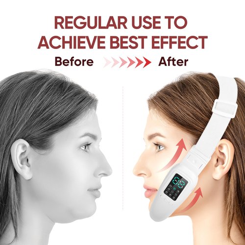 Ceymodir Intelligent Electric Double Chin and V-Shaped Face Machine with 8 Modes & 15 Adjustable Intensities - Women's V-Face Device - White