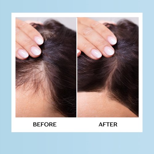 Mediceuticals HairGain - Unisex Supplement - 60 Tablets