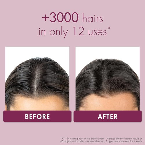 Klorane Intense Strengthening Serum | Quinine Formula for Thicker, Stronger Hair - 3.3 fl. oz.