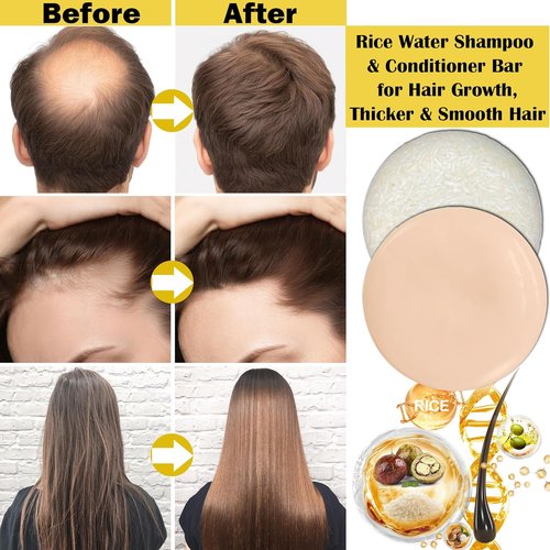 Skiennix Rice Water Shampoo & Conditioner Set - Organic Hair Growth & Deep Cleansing | 2 Pack