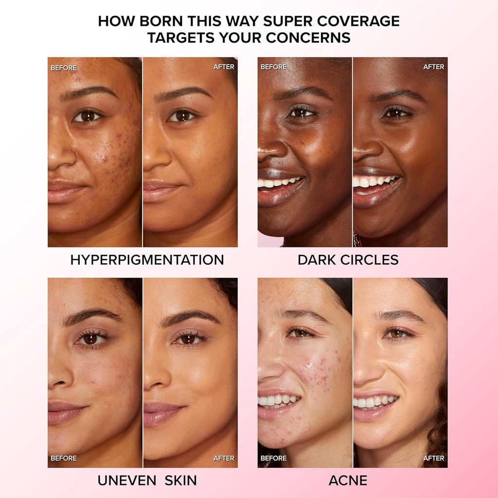 Too Faced Born This Way Concealer - Full Coverage, Non-Comedogenic & Long Lasting | Infused with Hyaluronic Acid & Coconut Water