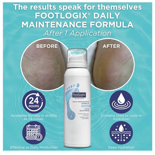 Footlogix Daily Maintenance Formula - Moisturizing Foot Mousse for Normal to Dry Skin | 4.23oz