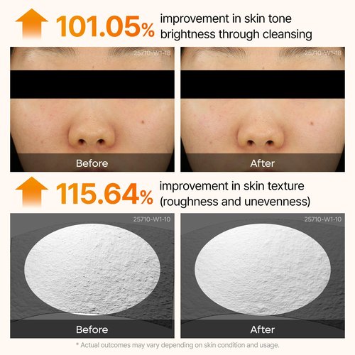 Dr. Melaxin Peel Shot Kojic Acid Turmeric Serum – Exfoliating Dark Spot Corrector with AHA/BHA & Niacinamide, Brightening & Even Tone Facial Serum (80ml / 2.70 fl oz)