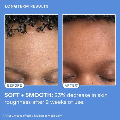 Experiment Molecular Mesh Barrier Repair Face Moisturizer - Soothing Lightweight Cream for Strength & Redness Relief - Ectoin & Centella, 2 FL OZ - Vegan Formula for Sensitive Skin