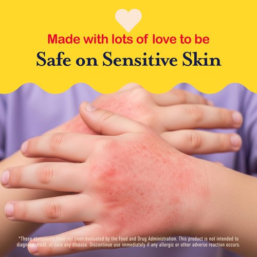 Hypochlorous Acid Spray For Kids - Soothes Diaper Rash, Baby Acne, Eczema, Cuts & Scrapes - Baby & Kids Skin Soothing Spray for Sensitive Skin, Non-Toxic, No Sting, 4 oz