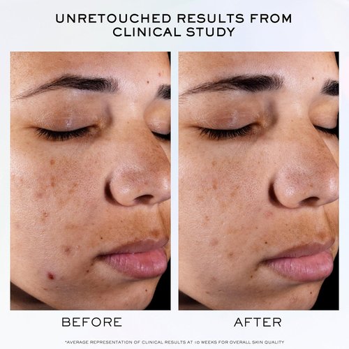 Lancôme Clarifique Pro-Solution Face Serum - Reduce Dark & Acne Spots with 10% PHA & Niacinamide