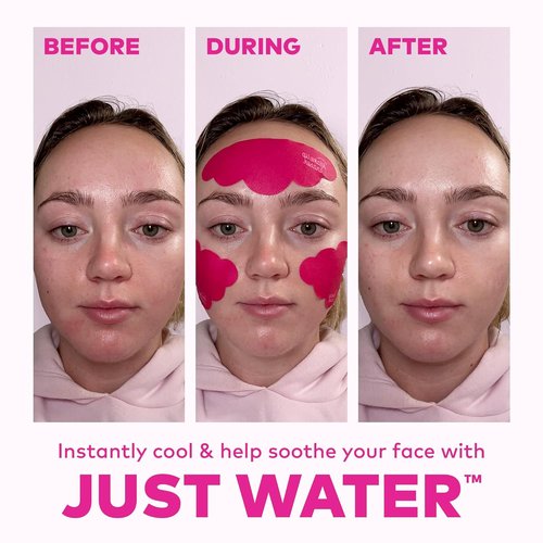 MakeUp Eraser Face Cooling Clouds - Reusable Facial Patches for Reducing Redness & Irritation - Instant Cooling