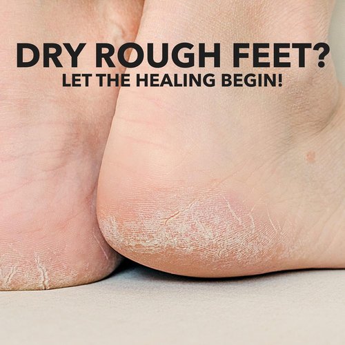 Adamia Therapeutic Foot Cream - Pure Macadamia Oil, Fragrance Free, 4 Ounce Tube | Paraben Free, Non-GMO