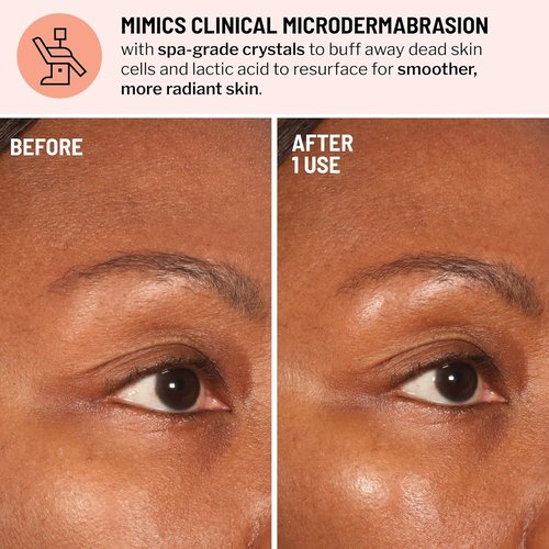 Dr. Brandt Microdermabrasion Exfoliator - Travel Size 0.7 oz | Refines Texture & Minimizes Fine Lines